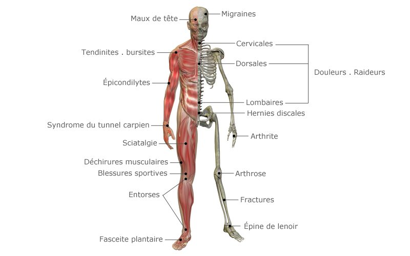 physiotherapie-clinique