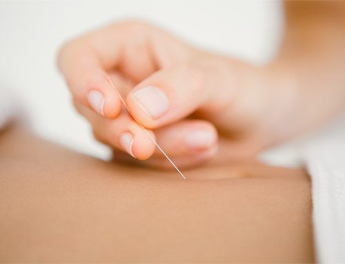 Acupuncture